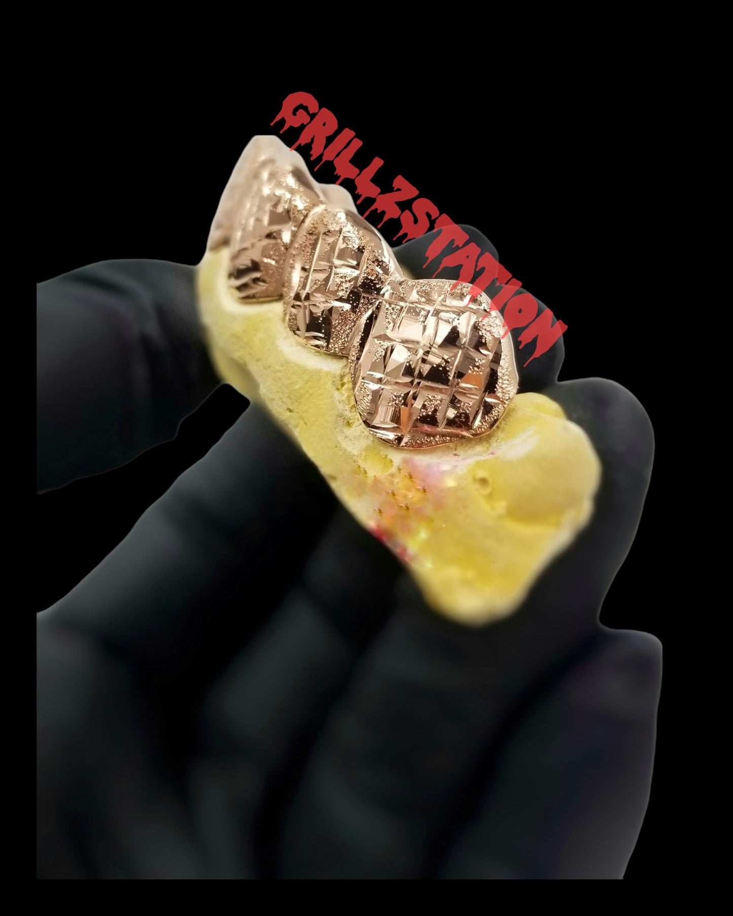 Ultra Diamond Cut Diamond Dust Teeth Grillz, Custom Handmade Solid Gold - GRILLZSTATION