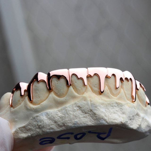Dripping Custom Grillz By GRILLZSTATION - GRILLZSTATION