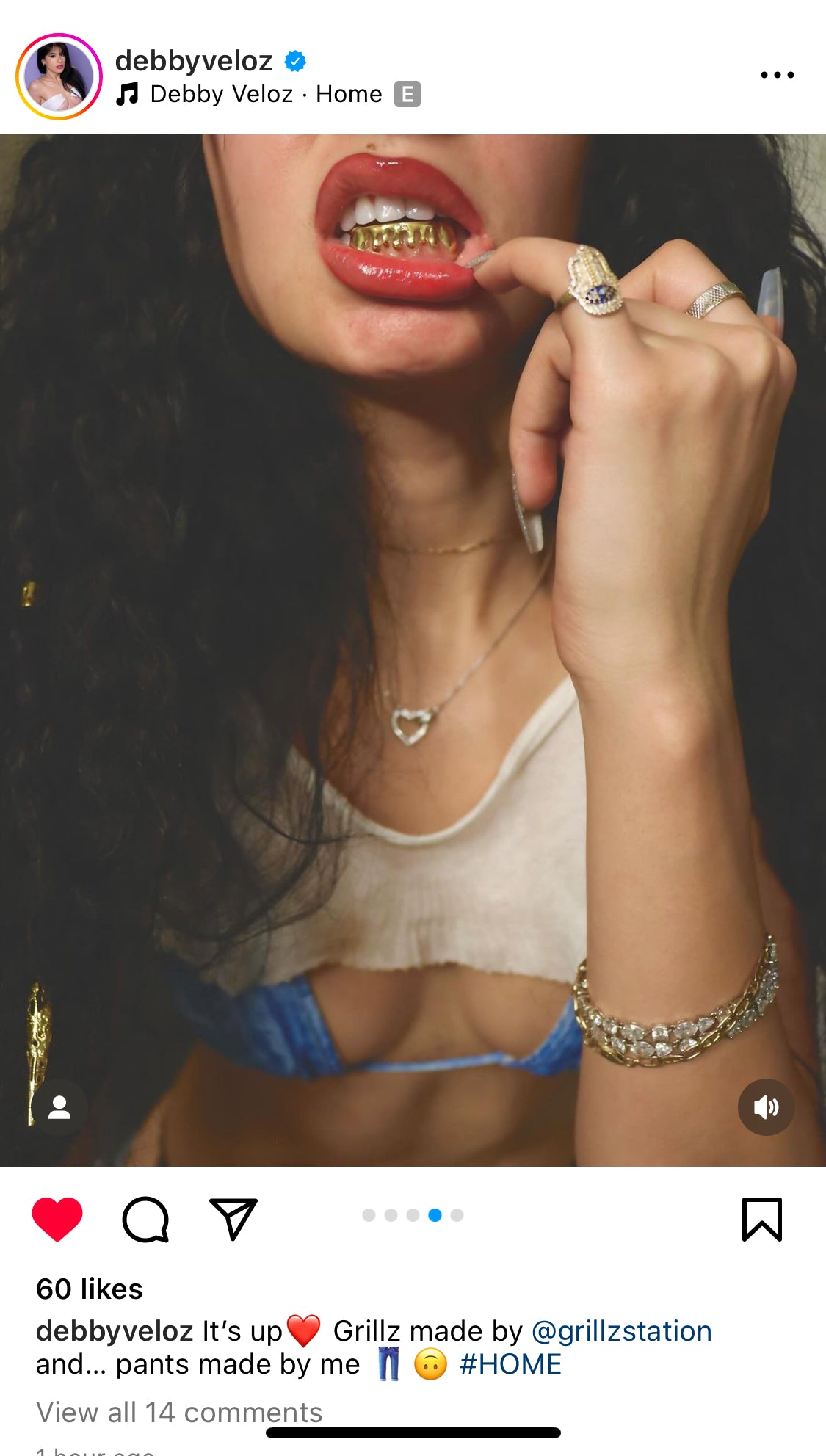 Water Dripping Gold Custom Grillz - GRILLZSTATION