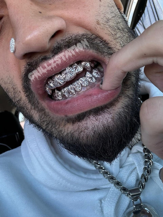 Starburst Cut Grillz, Diamond Dust Teeth Grillz, Custom Fitted Teeth Grillz, Yellow Silver Rose Gold Grillz, Dental Impression Kit Included - GRILLZSTATION