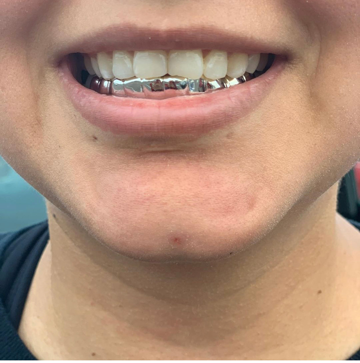 Solid Gold Grillz Made to Order, Custom Fitted Teeth Grillz - GRILLZSTATION