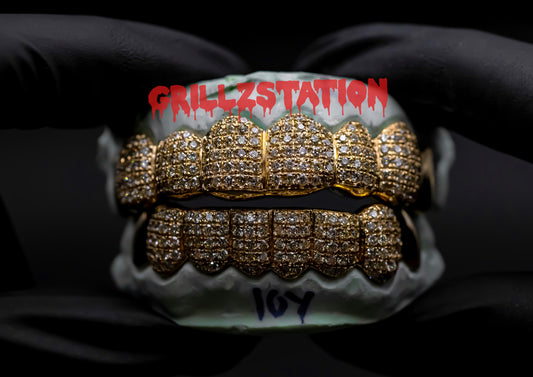 Best Custom Gold Grillz Online with free shipping and high quality