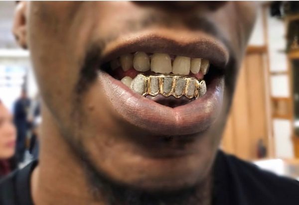 Diamond Dust Custom Grillz - GRILLZSTATION 