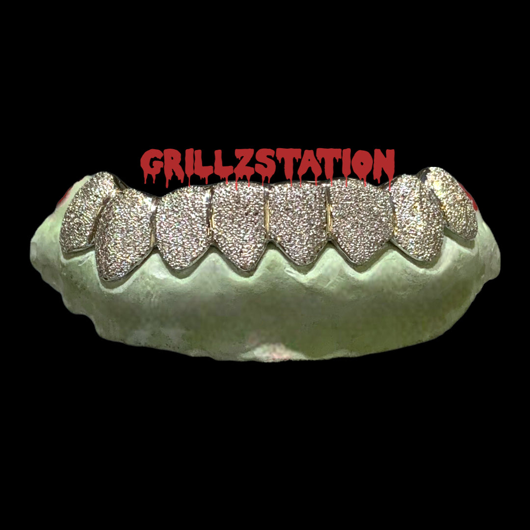 Diamond Dust Custom Grillz - GRILLZSTATION 