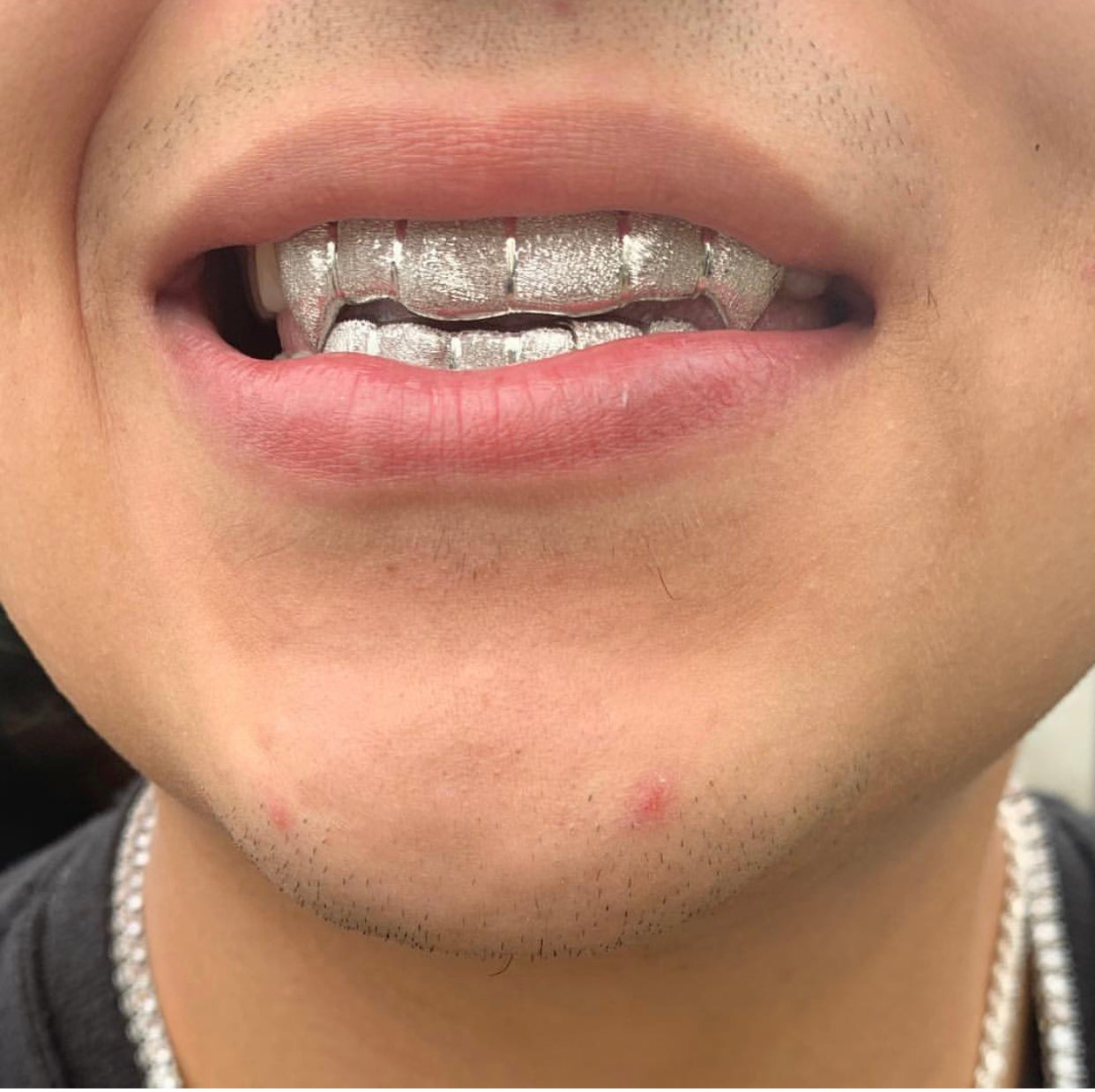 Diamond Dust Custom Grillz GRILLZSTATION