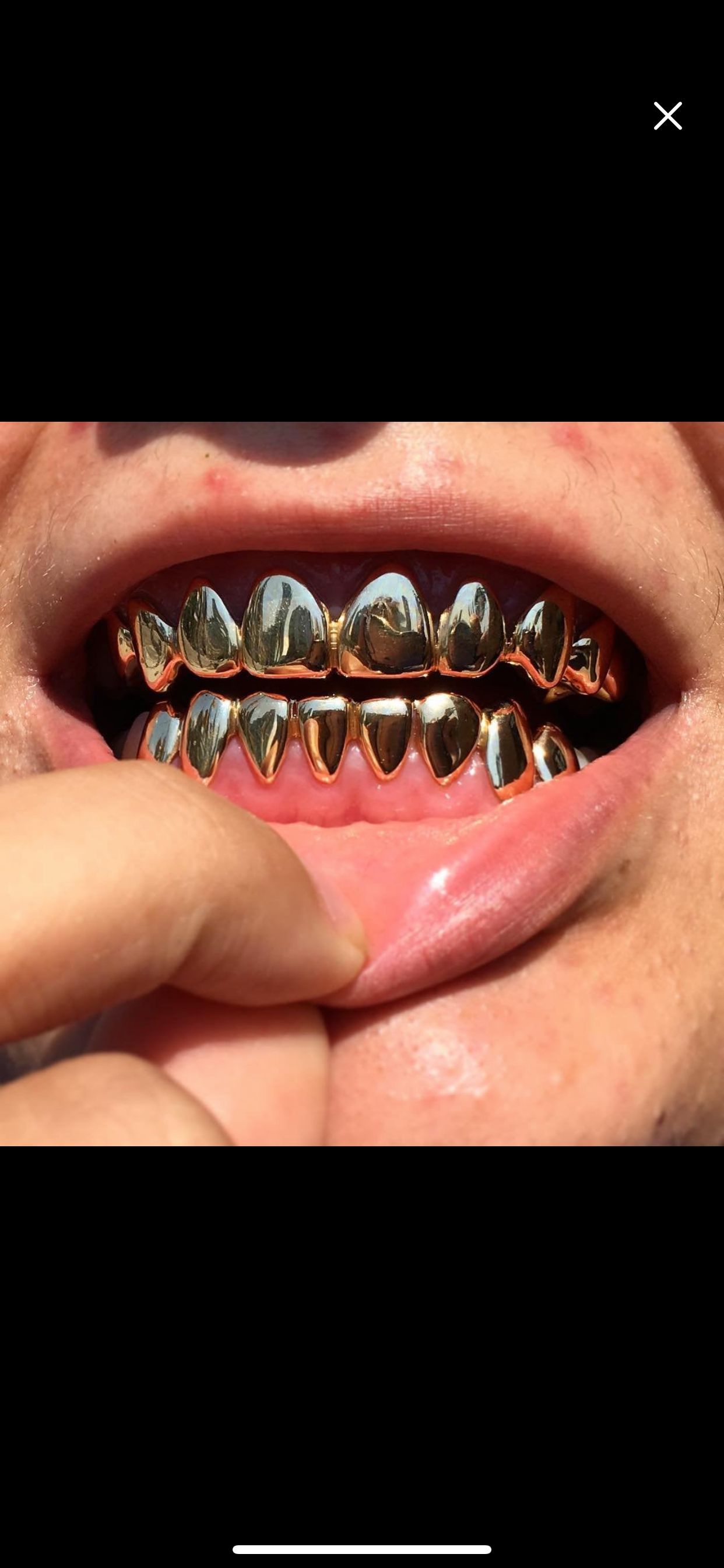Solid Gold Grillz Made to Order, Custom Fitted Teeth Grillz - GRILLZSTATION 